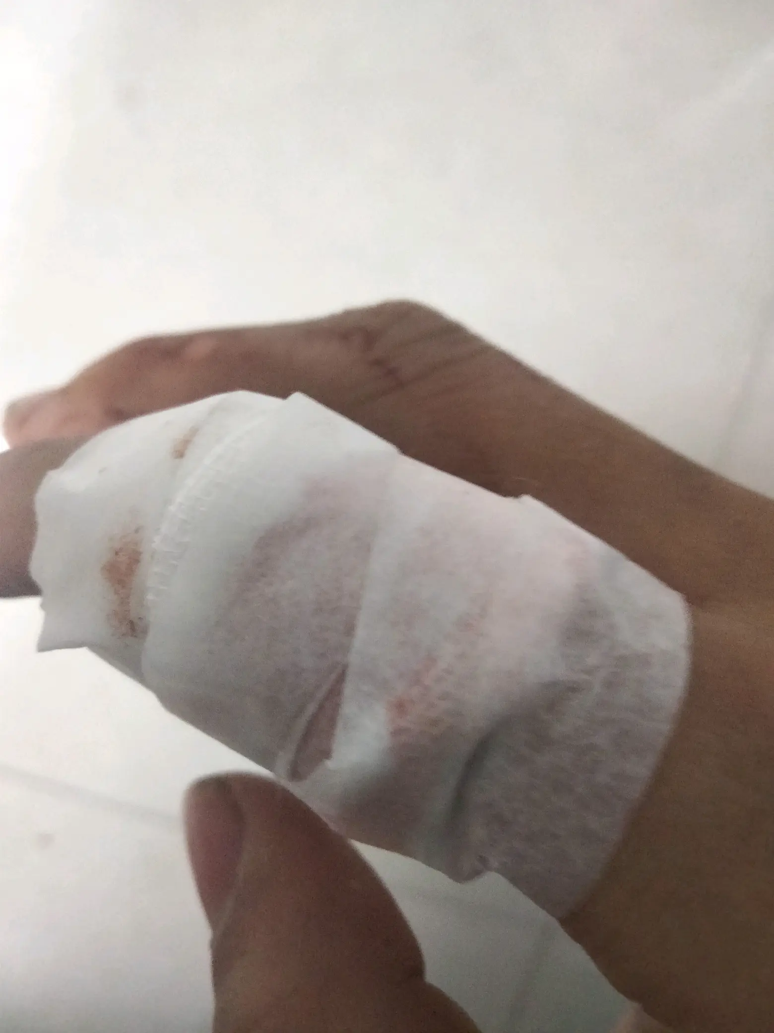 手被划伤