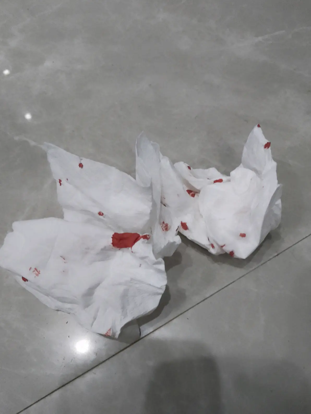 要把脚给抠出血来了,然后他就一直拿那个纸巾擦擦擦,然后那个血一直流