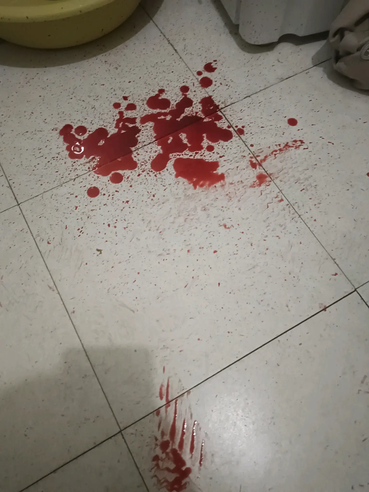 蹲完坑起来磕到玻璃镜子,人生第二次流这么多血,望周知