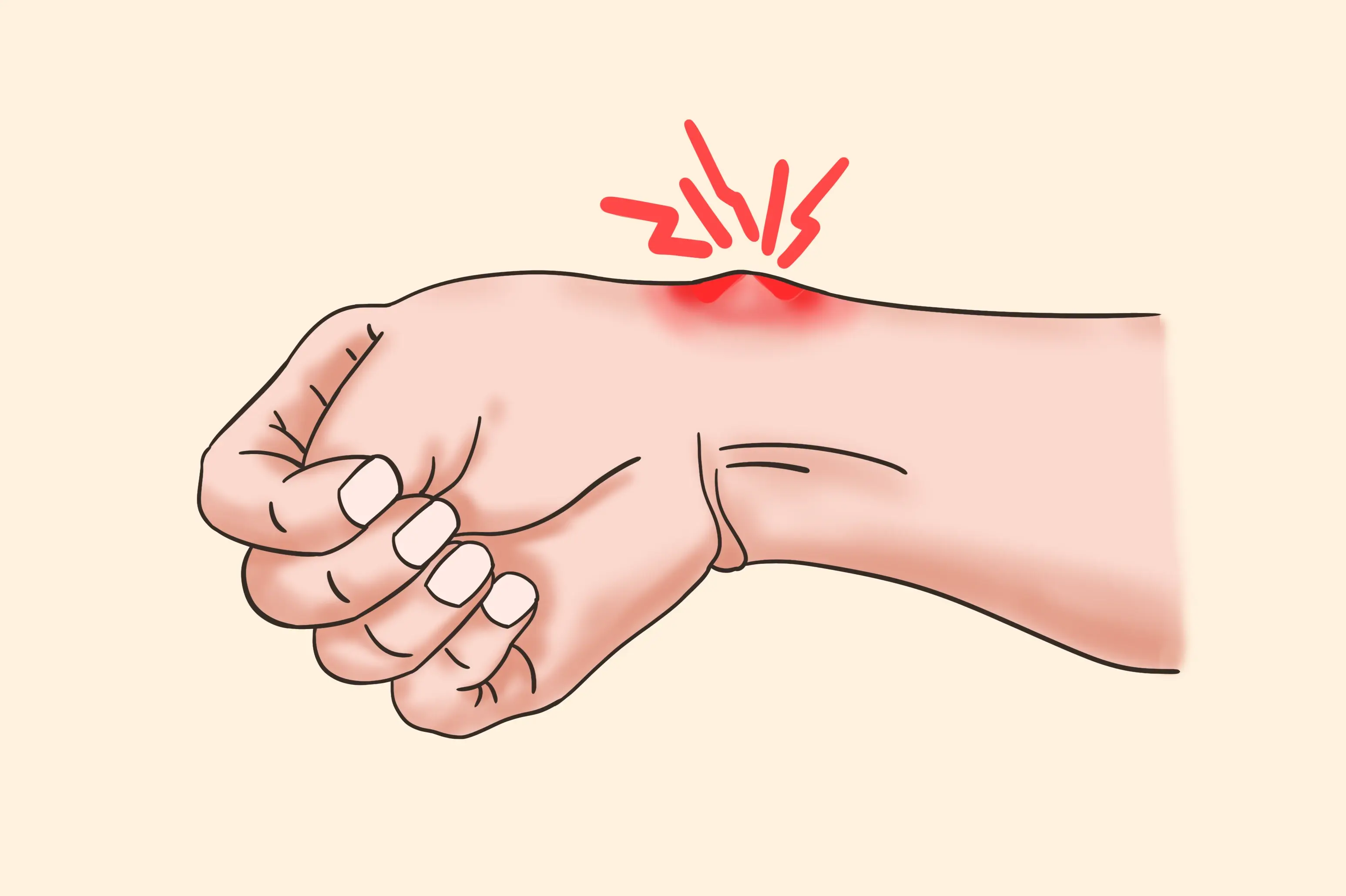 腱鞘炎引发疼痛怎么办?用这个方法,在家自己也能做!