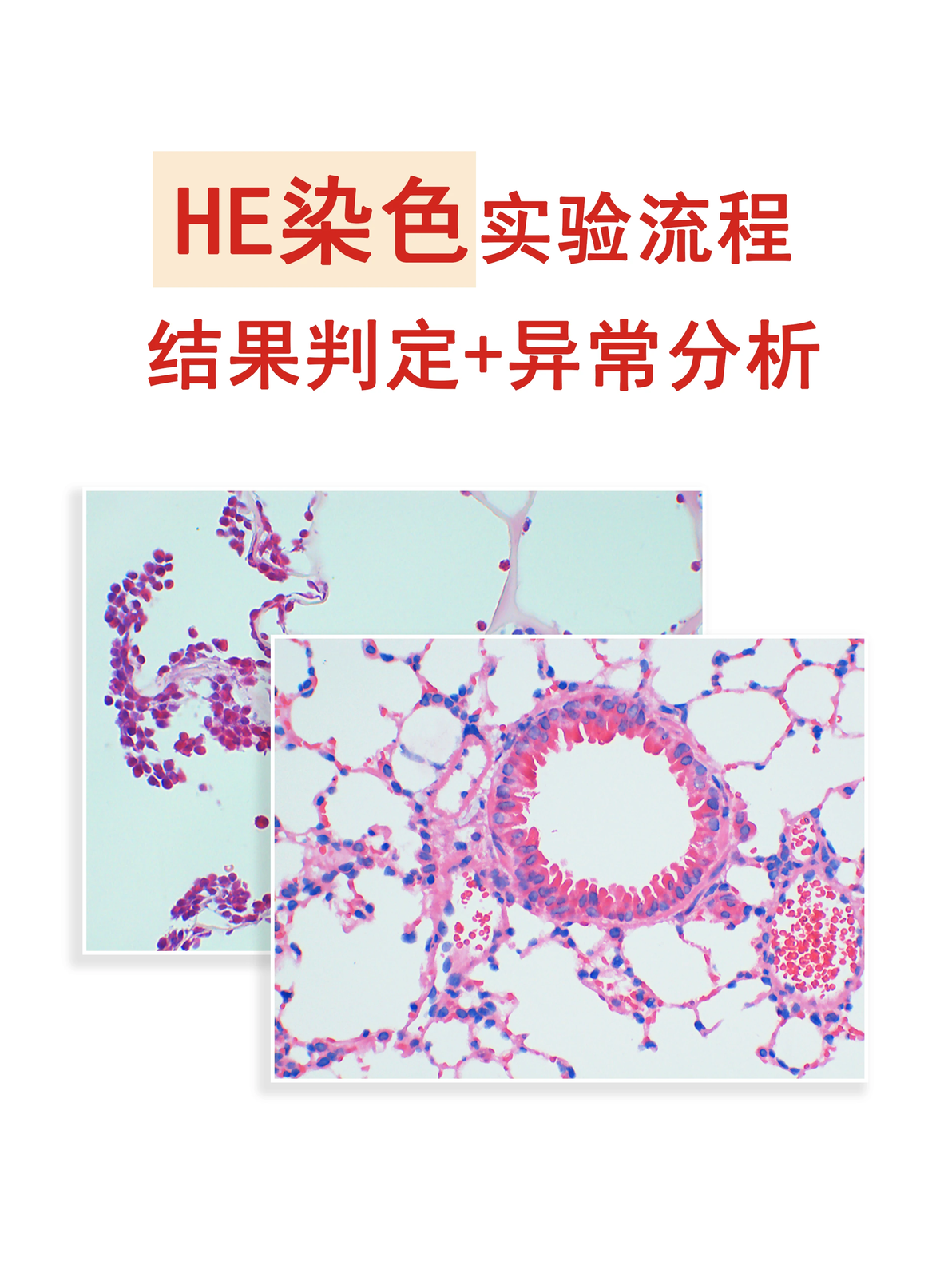 HE染色：实验流程+结果判定+异常分析 - 哔哩哔哩