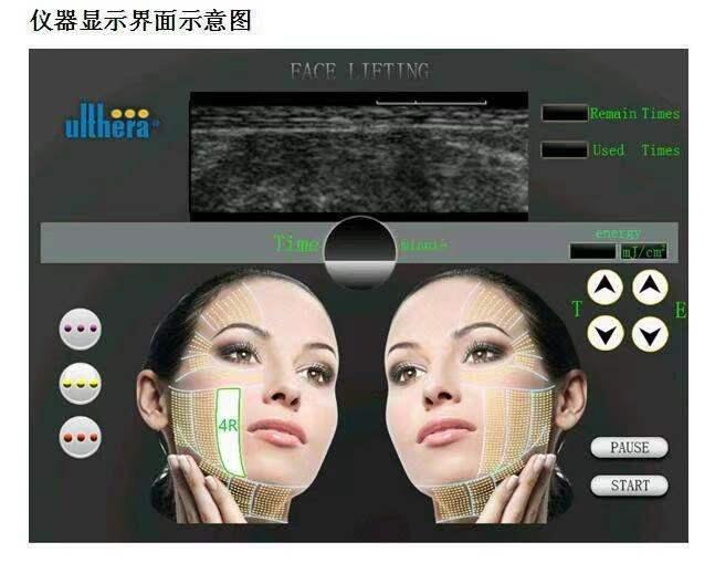 盘点超声刀的原理与作用、超声刀多久出效果~ - 哔哩哔哩