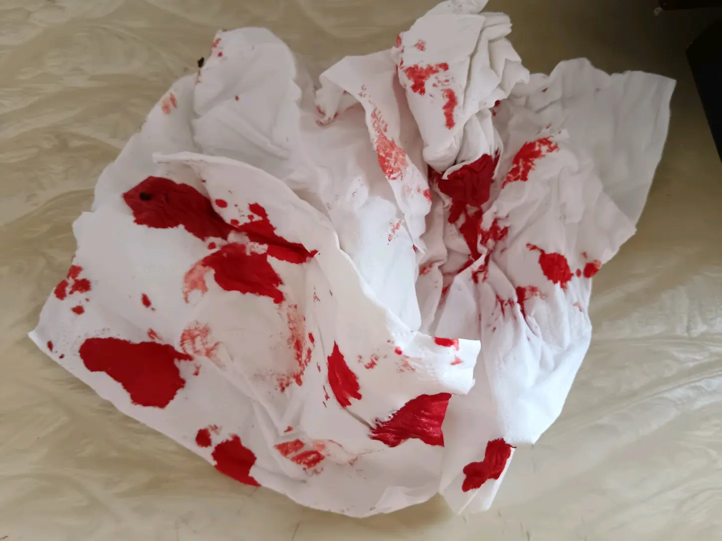 分,醒后鼻子堵塞,一起身鼻子框框流血,吓得我赶紧拿手接住然后找纸巾