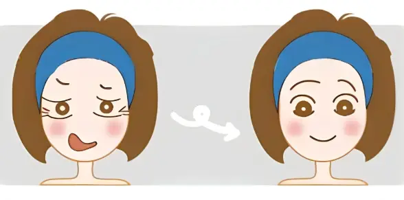 烟台曙光医院讲解鱼尾纹改善:显老眼纹是怎么形成的?