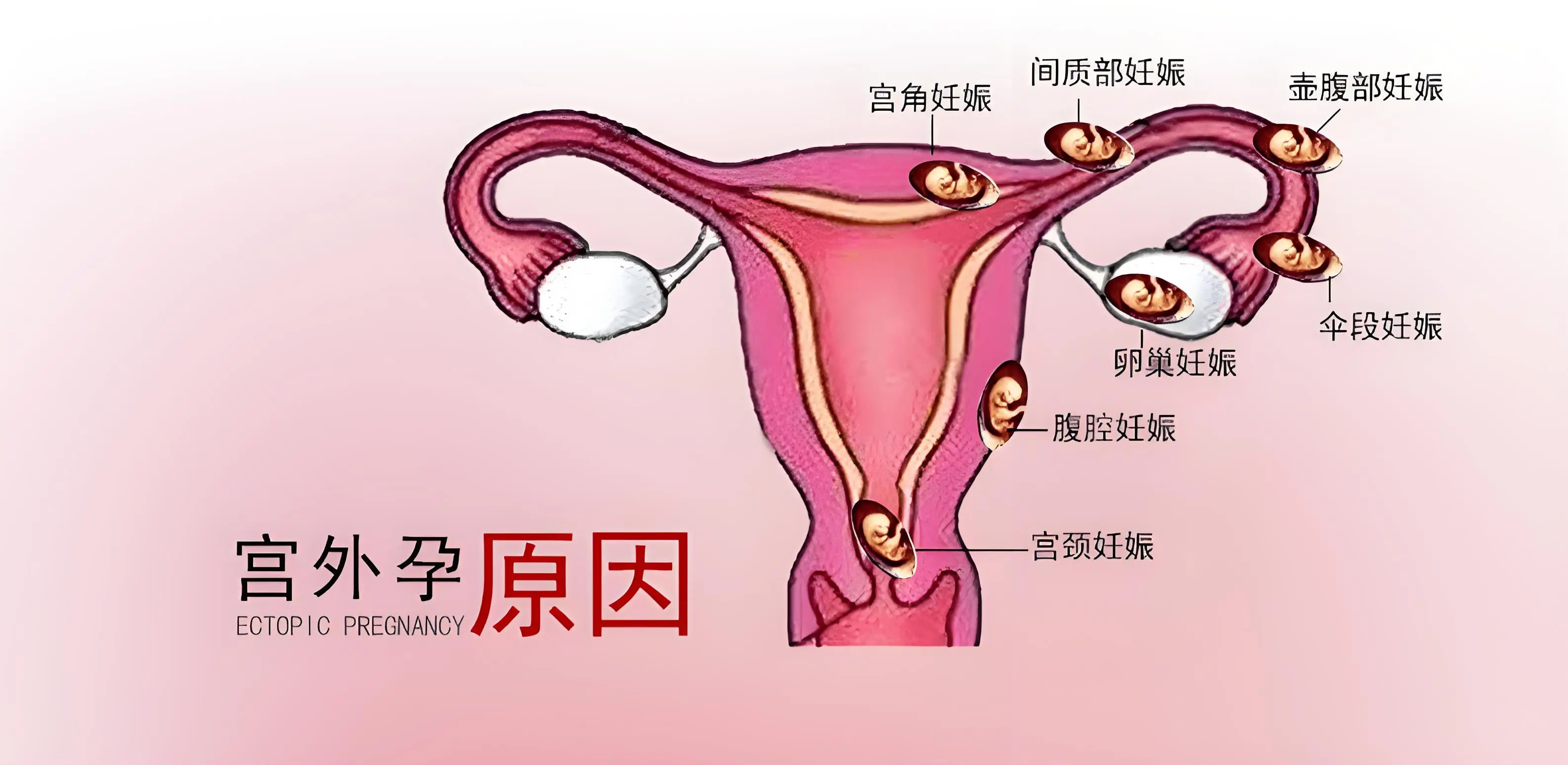 输卵管形状介绍图图片