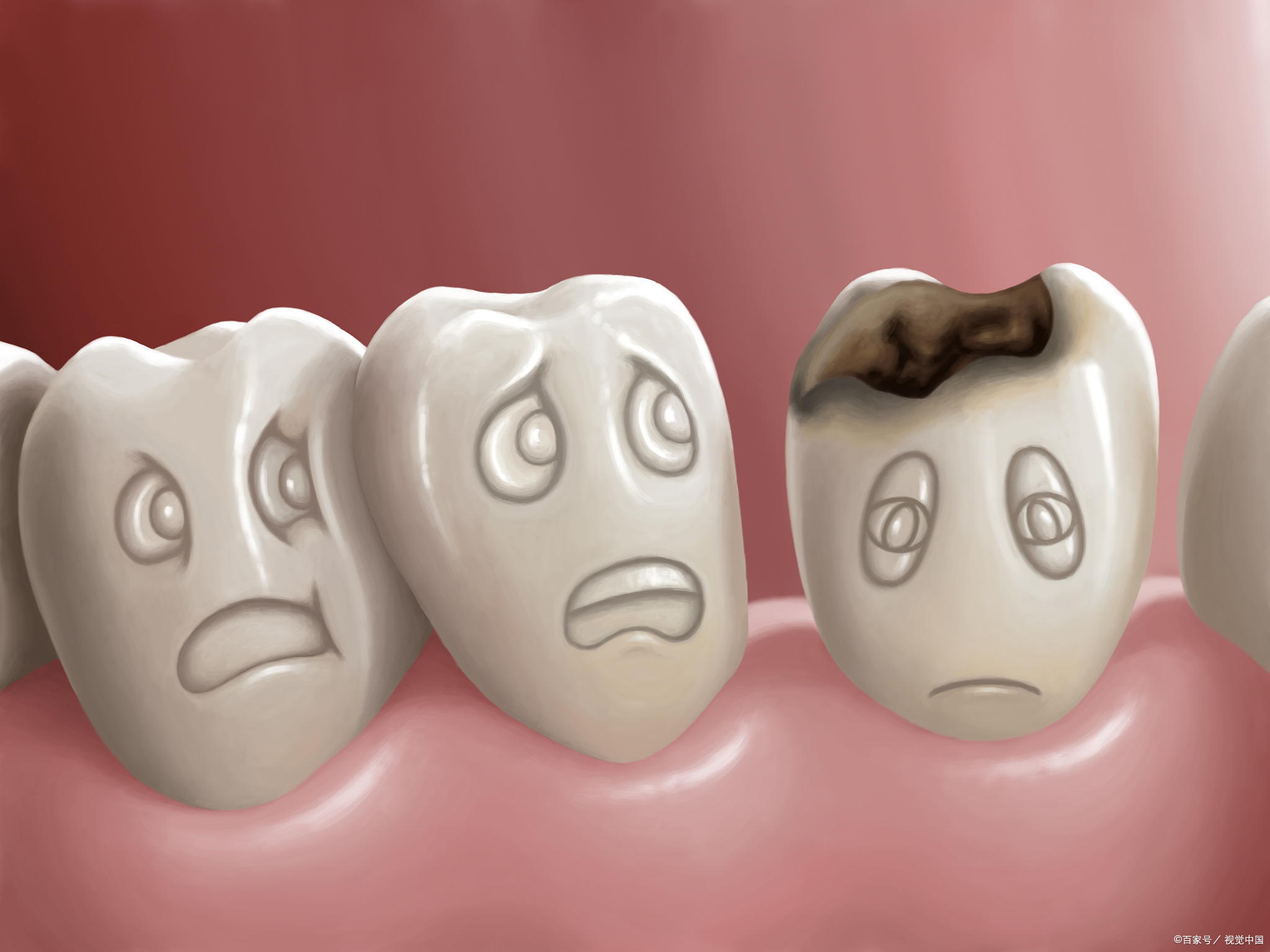 牙根黑怎么办妙招（牙齿都烂了，就剩下黑黑的牙根？分这4种情况来治疗） | 说明书网