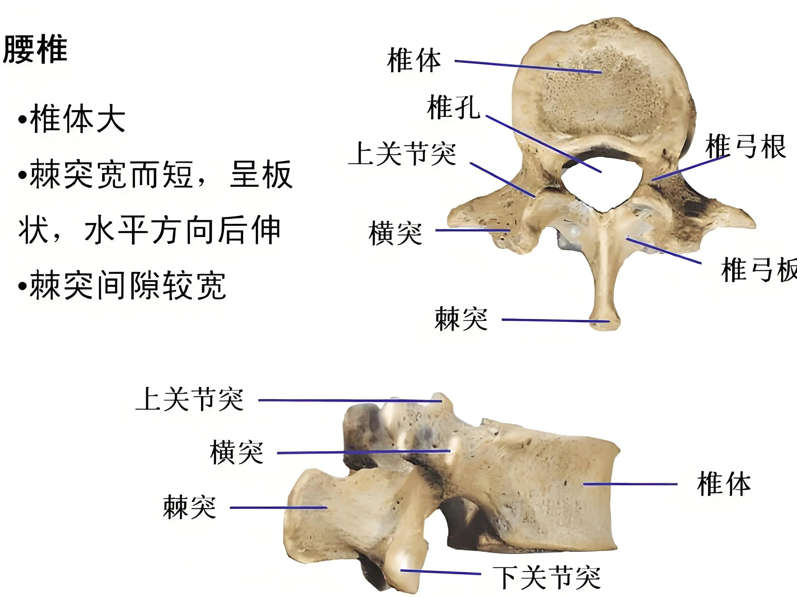 腰穿层次解剖图图片