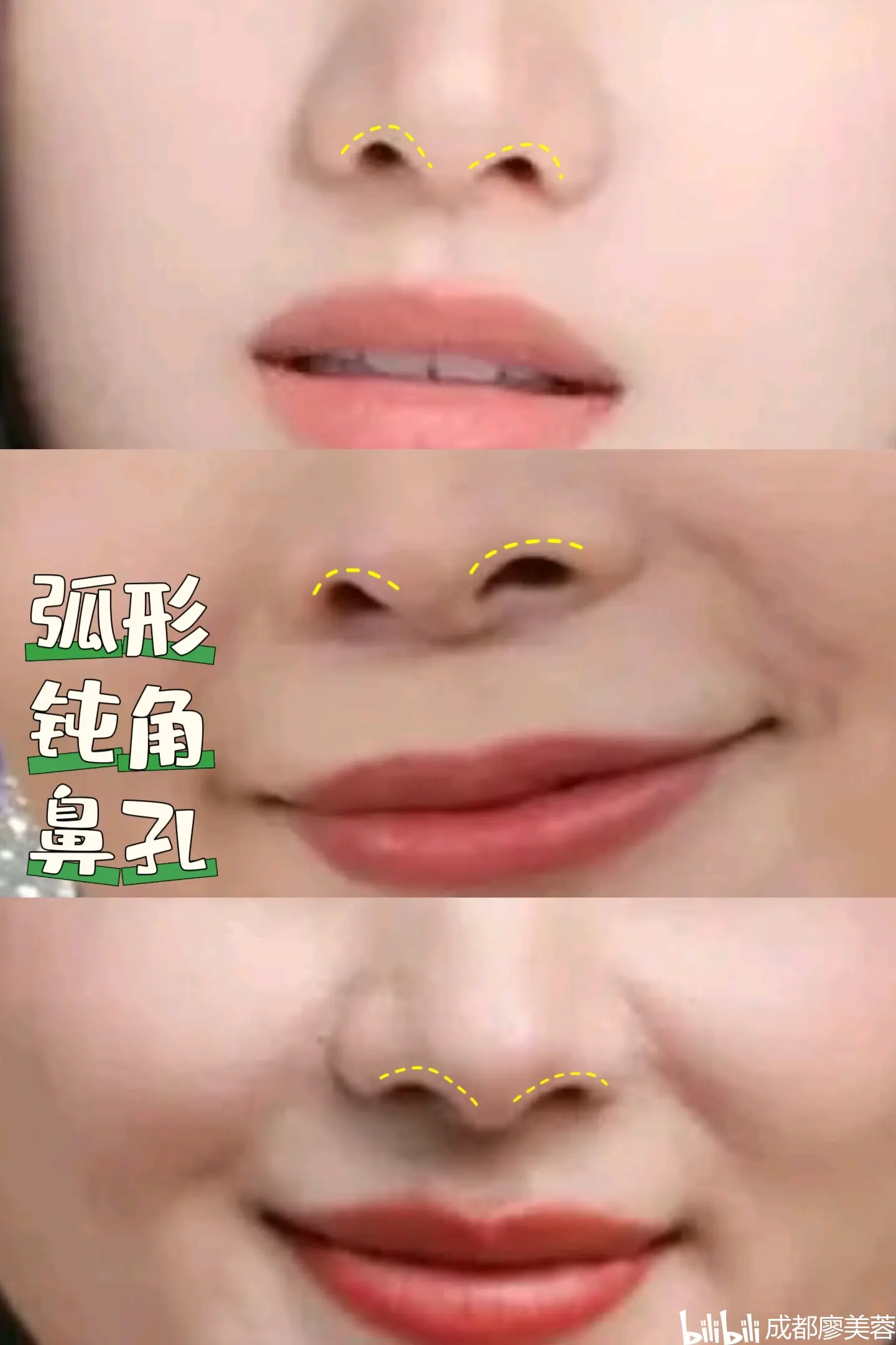 当你的鼻孔是三角形锐角状态,请注意!