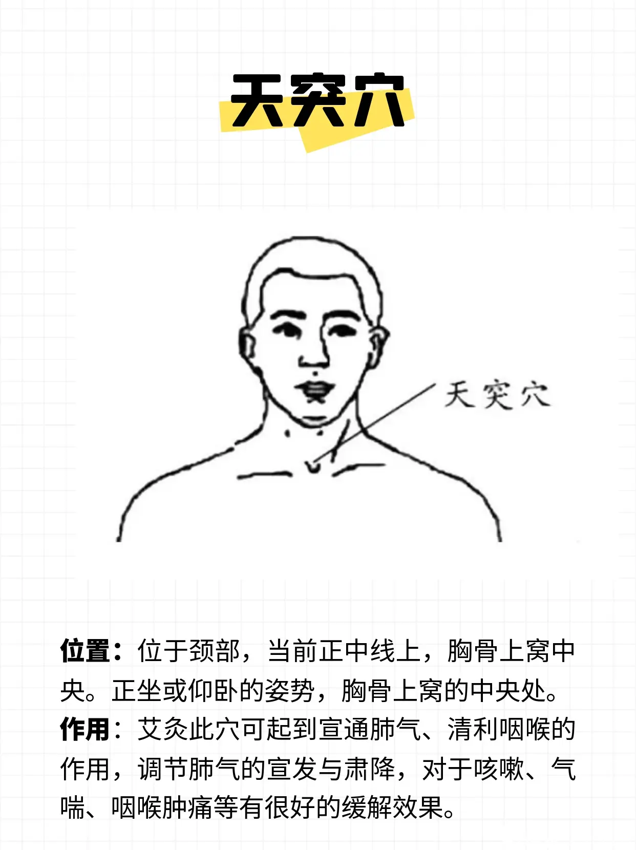 推荐艾灸:呼吸道大三角,由天突穴和内关穴组成,由于穴