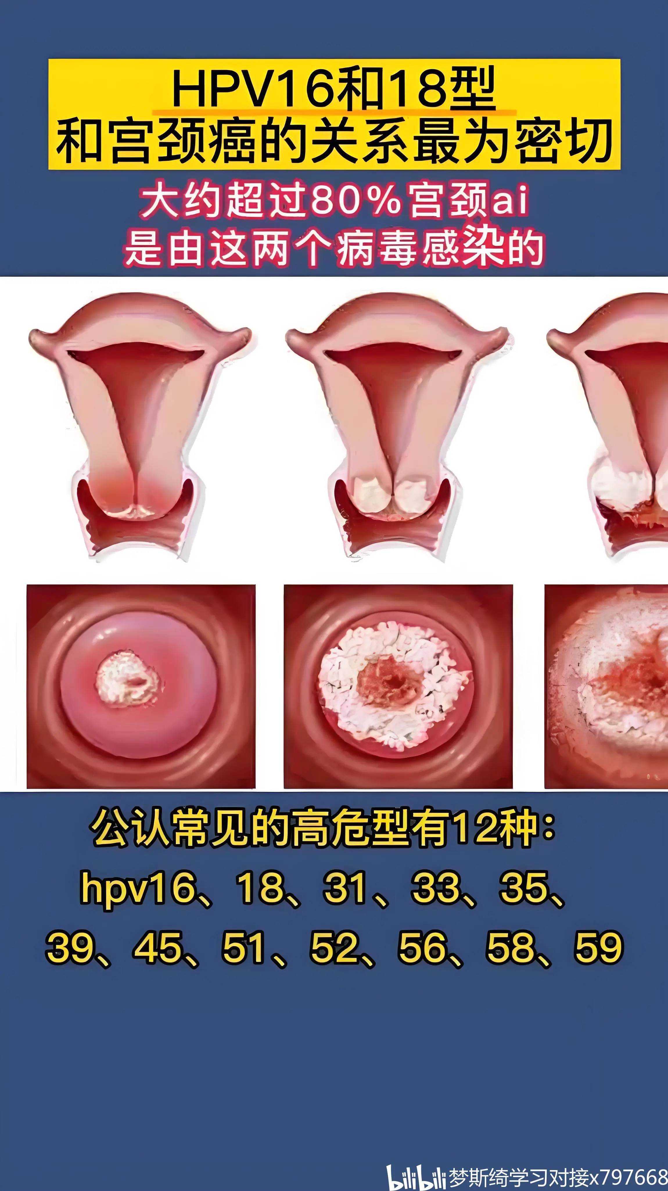 hpv病毒女性症状图片图片