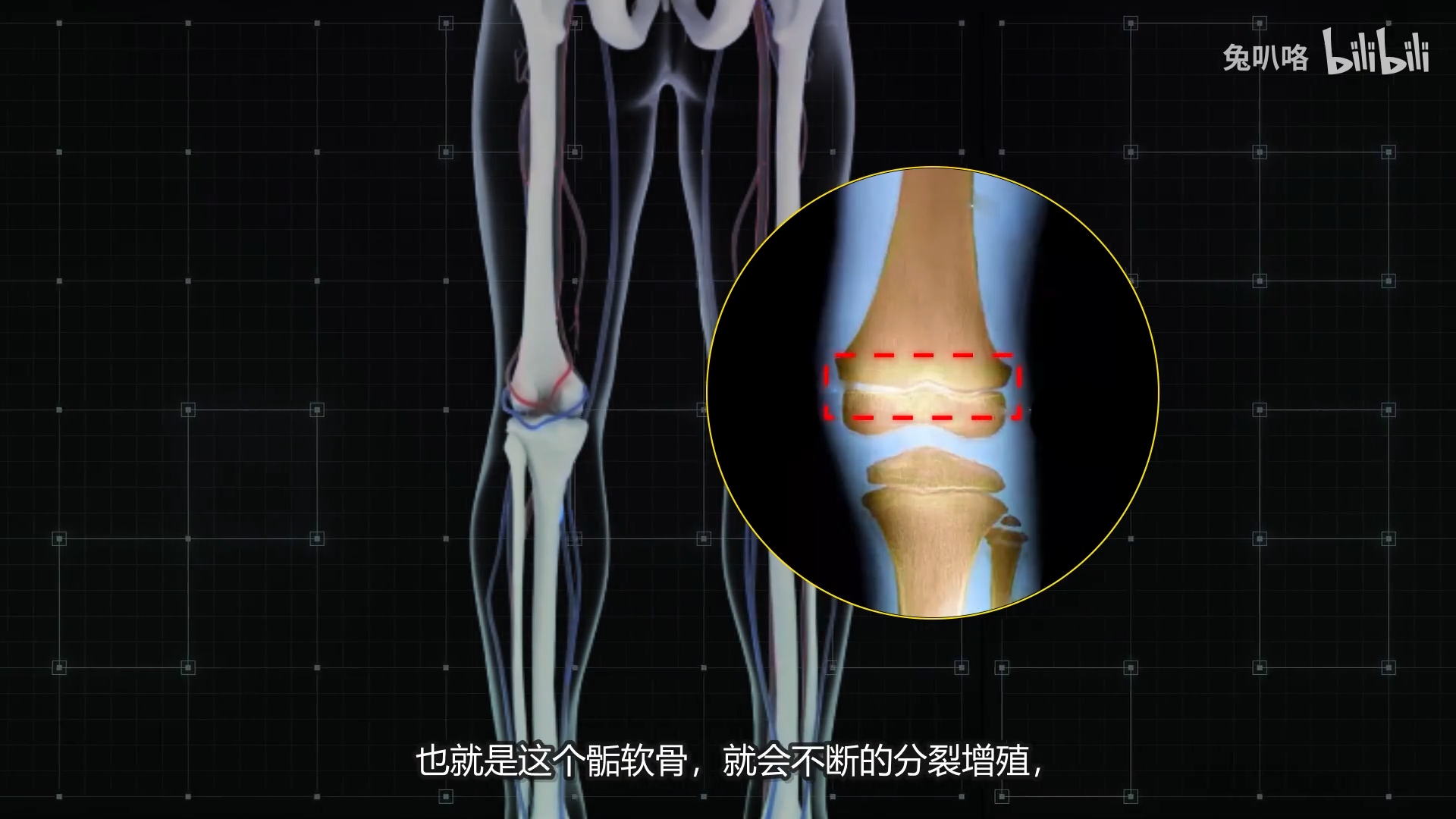 長骨包含中間的骨髓和骨骺,人在生長的時候骨骺部分有一層骺軟骨