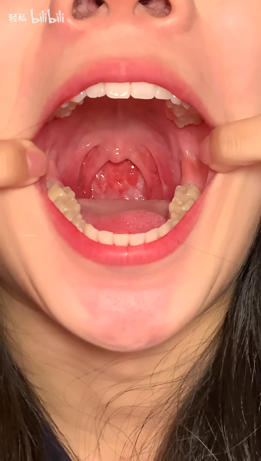 小姐姐让你做口腔检查呀