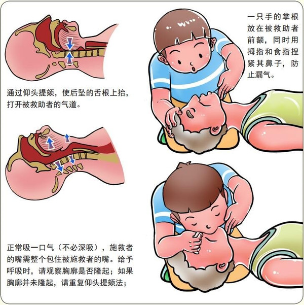 心肺复苏流程图卡通图图片