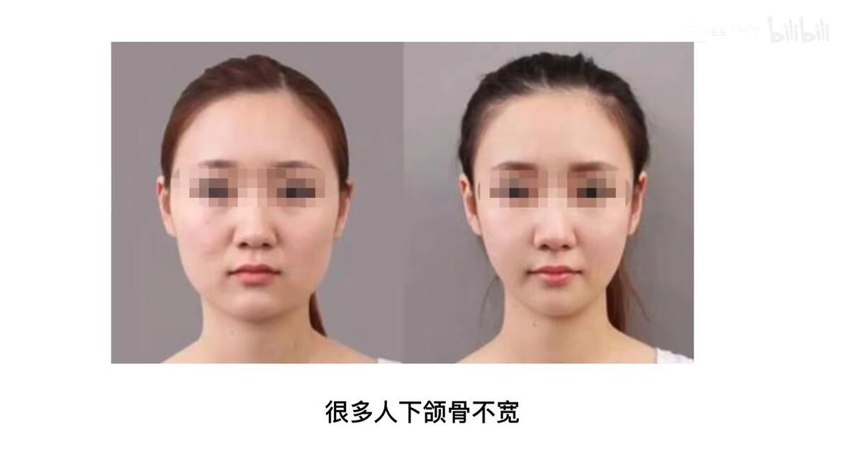 咬肌型方脸！一个动作让你摆脱顽固咬肌！ - 哔哩哔哩