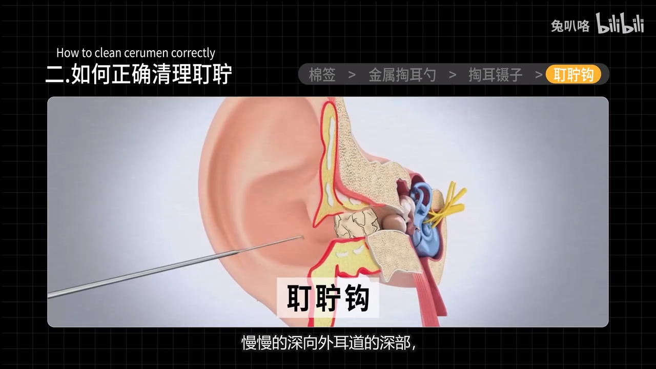 醫學博士掏耳朵會聾嗎i一輩子不掏耳朵什麼樣