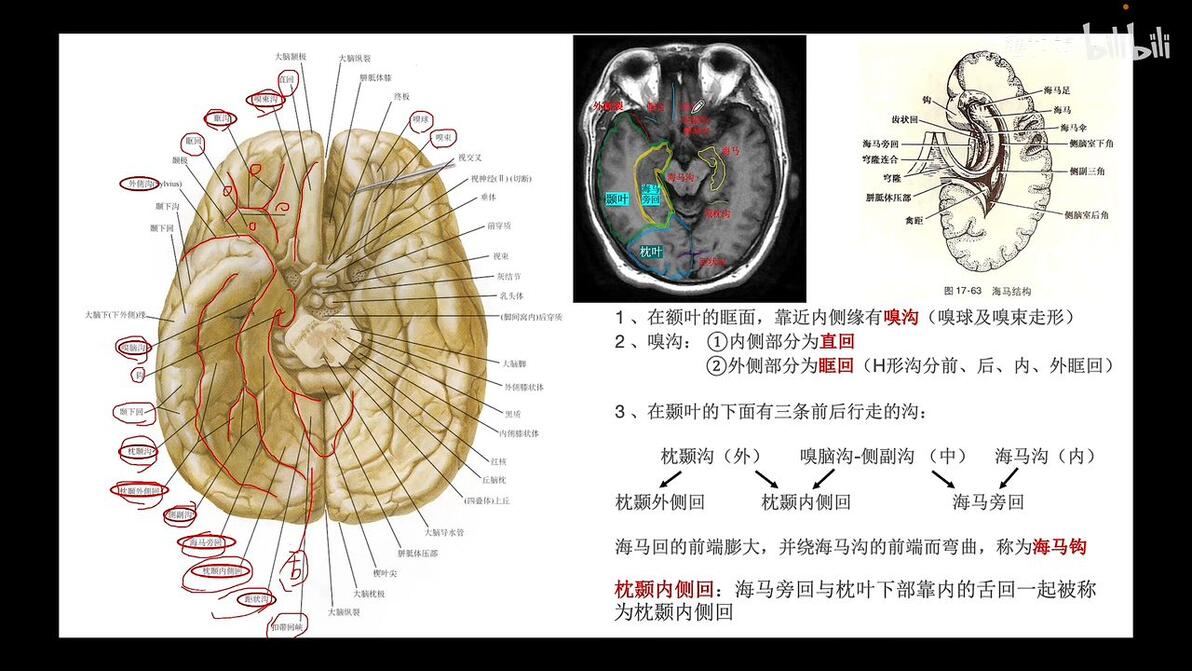 详细分解头颅解剖及CT/MRI(脑沟/脑回/脑叶上篇) - 哔哩哔哩