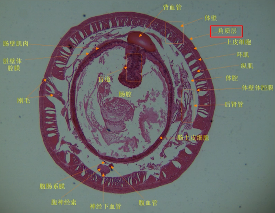 2蚯蚓的橫切片特徵 p16 - 01:1613是一個由液體充滿的囊,肌肉收縮的