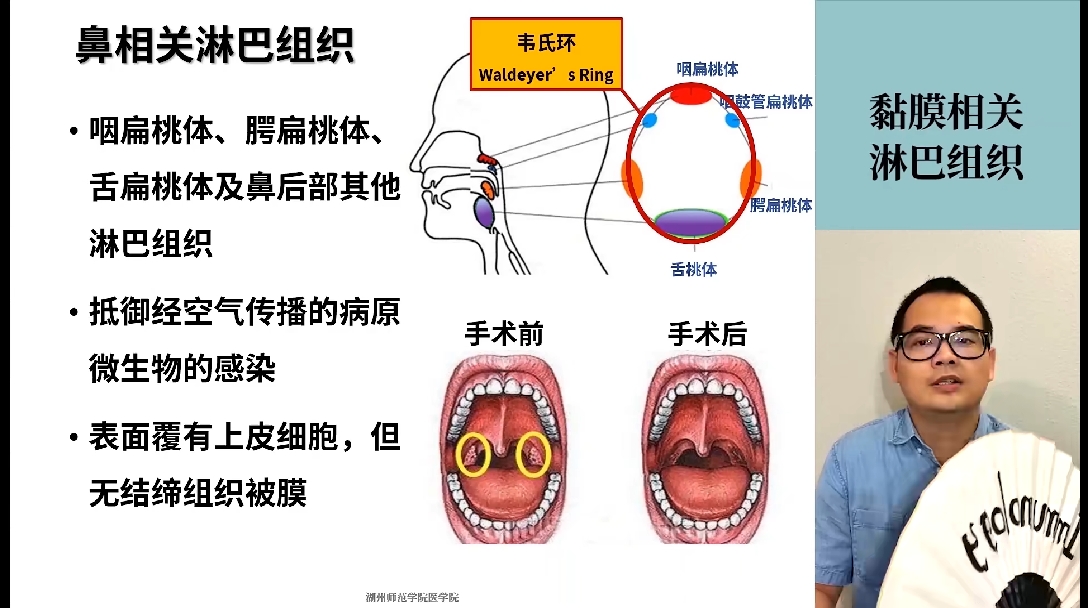 virchow淋巴结图片