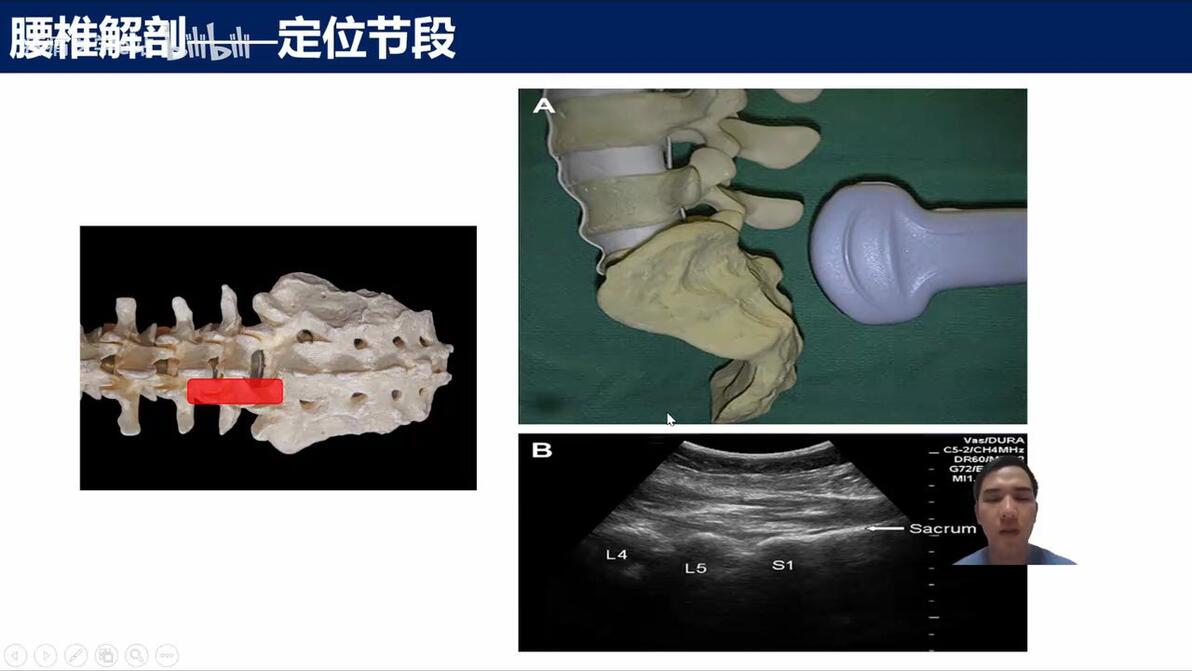 腰椎小关节疼痛治疗全解析｜超声引导神经阻滞技术（医学生/医生必看） - 哔哩哔哩