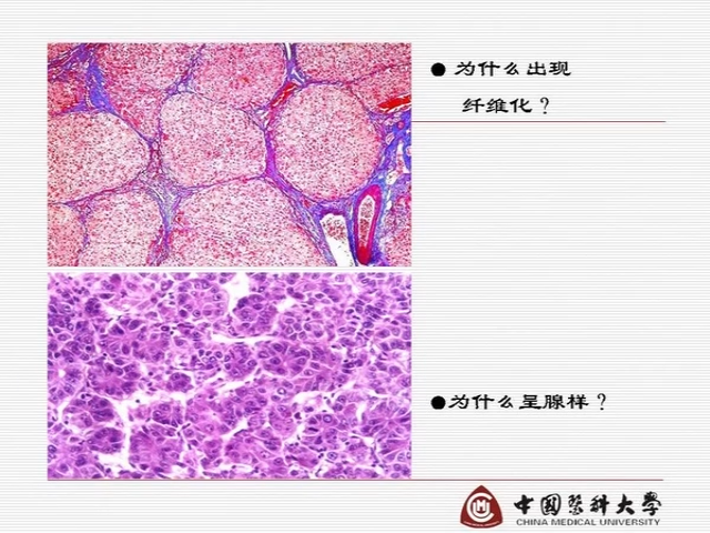 正常肝脏病理切片图解图片