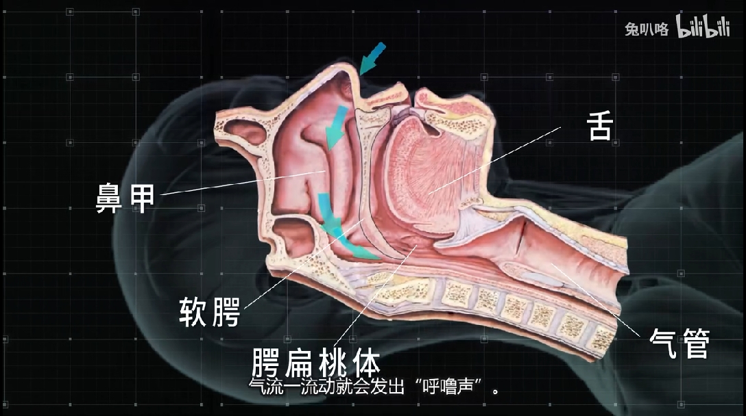 打鼾原理图片